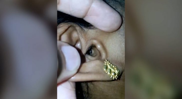 araignee-vivante-oreille